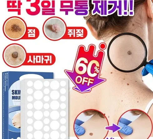 당신이 기다려온 쥐젖패치 베스트9